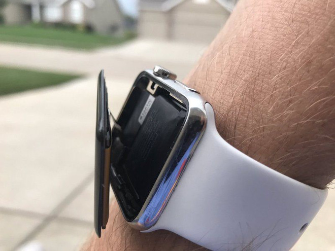 Apple Watch bị phồng pin khiến màn hình nứt vỡ, Apple cho rằng đó là lỗi người dùng - Ảnh 1.