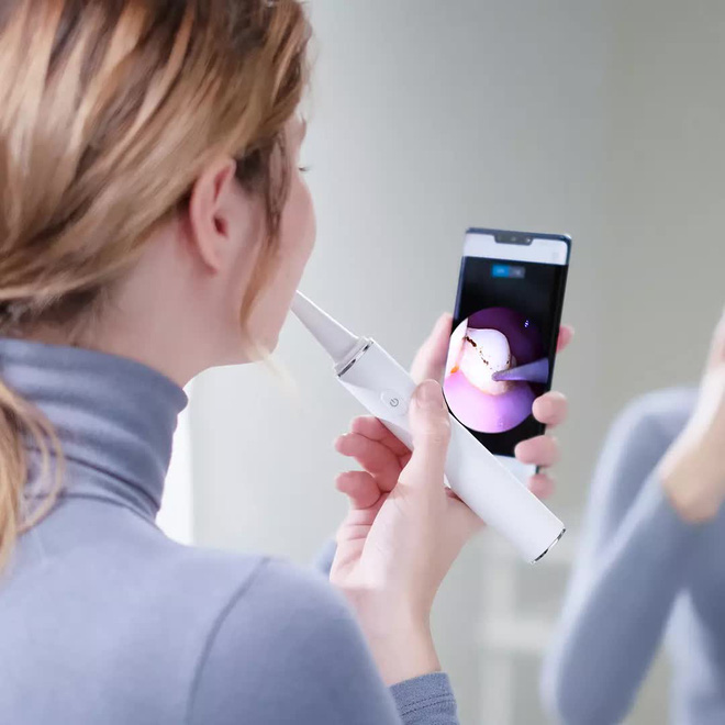Xiaomi ra mắt máy lấy cao răng siêu âm: Nhỏ gọn, tích hợp camera, kháng nước, giá 710.000 đồng - Ảnh 3.