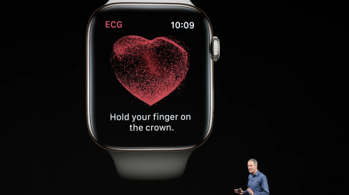 Apple Watch tạo dương tính giả, có thể làm đến 90% người nhận được cảnh báo tưởng mình mắc bệnh tim