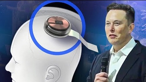 Elon Musk sắp cấy chip vào não người, giúp người liệt đặt hàng online, lướt web bằng sóng não